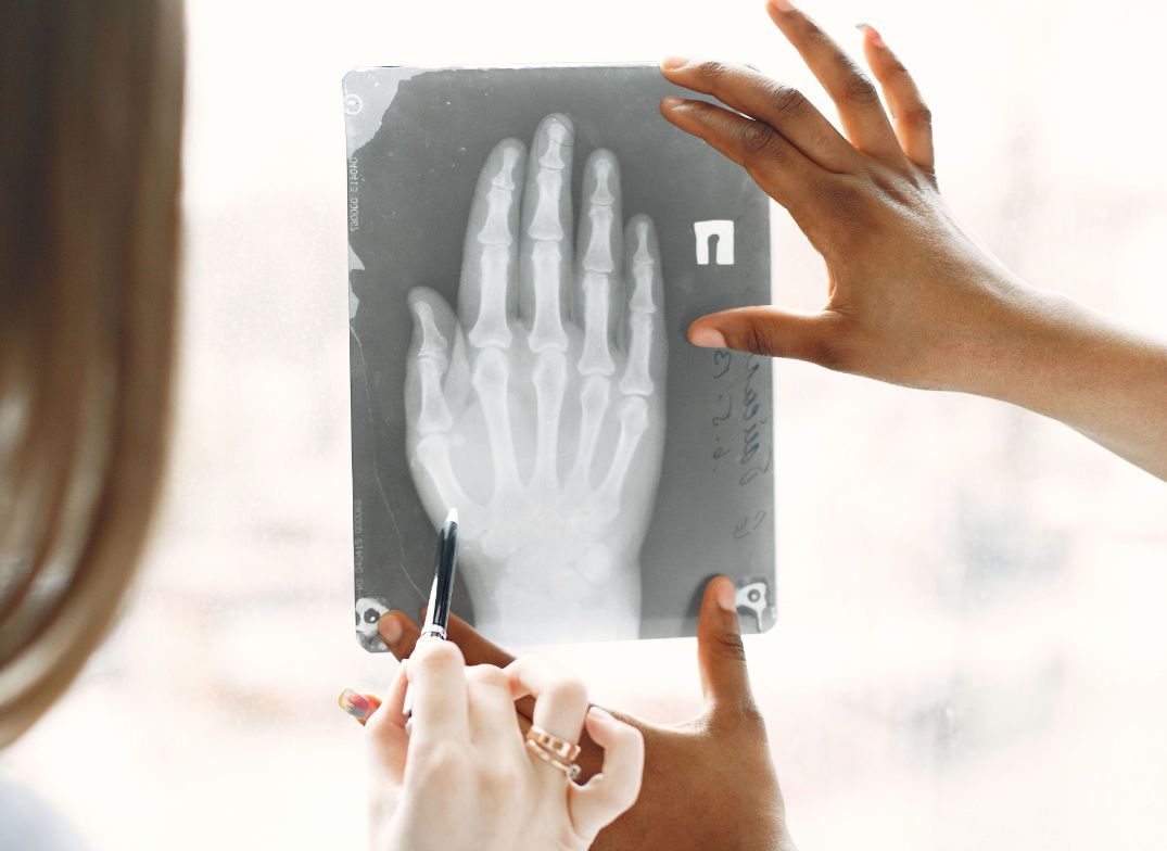 Arthritis care