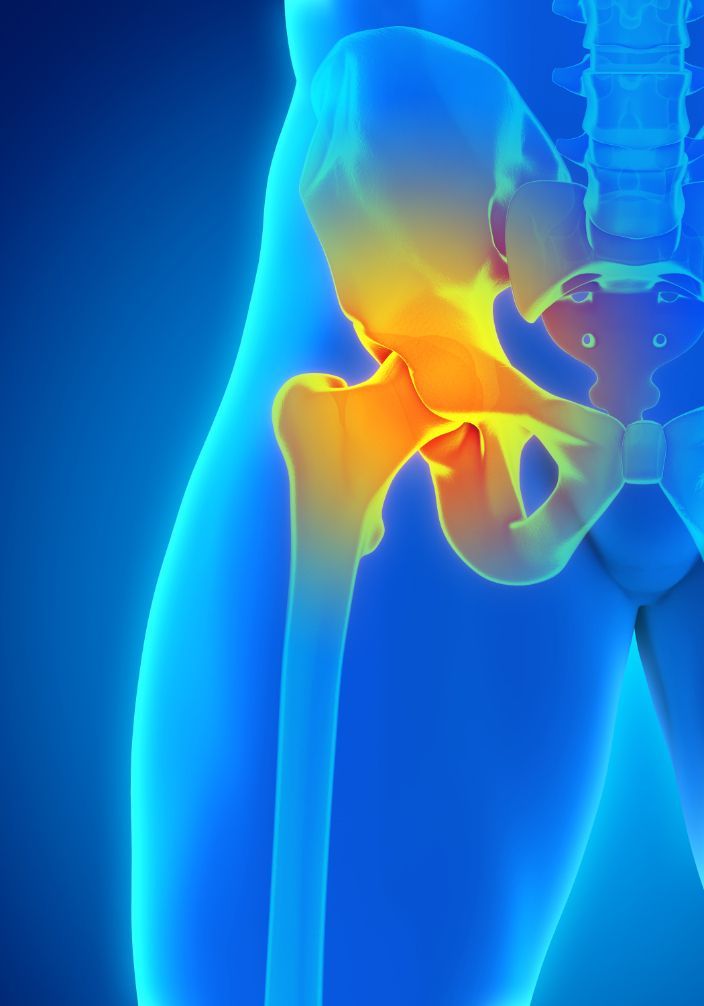 Hip Pain