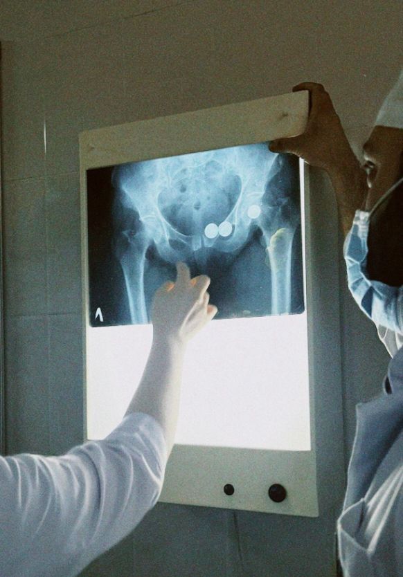 Hip Pain