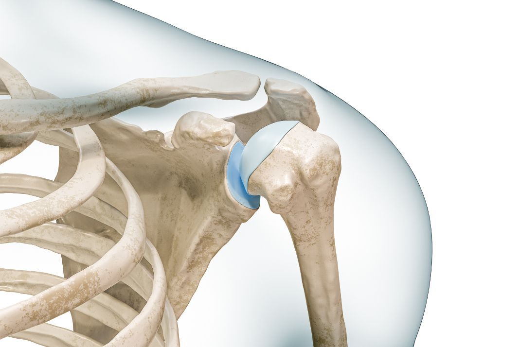 Shoulder Surgeon