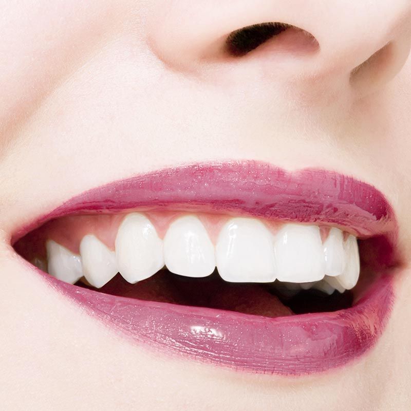 Estetica - Studio Dentistico Donati Sarti Frenguelli Ferroni - Sansepolcro