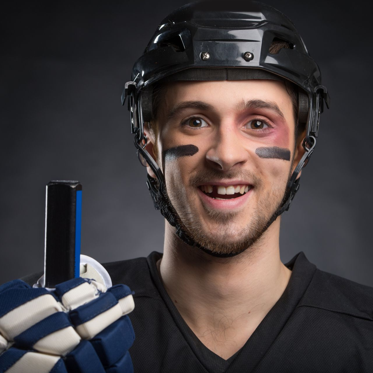 Smiling hockey player missing a tooth that needs an implant