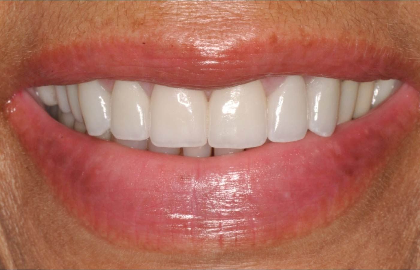 Close-up of a smiling mouth with bright white teeth and full, glossy pink lips.
