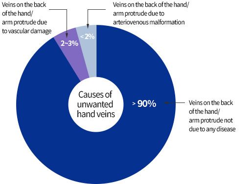 Types of prominent hand veins assessed before hand vein treatment at LEDAS, Korea