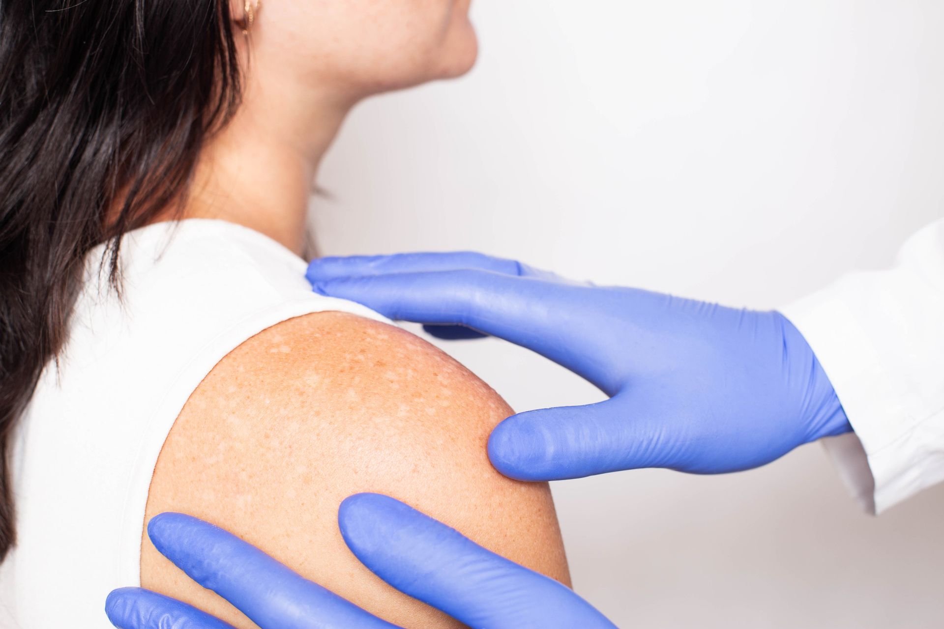 A doctor is examining a woman's arm with blue gloves.