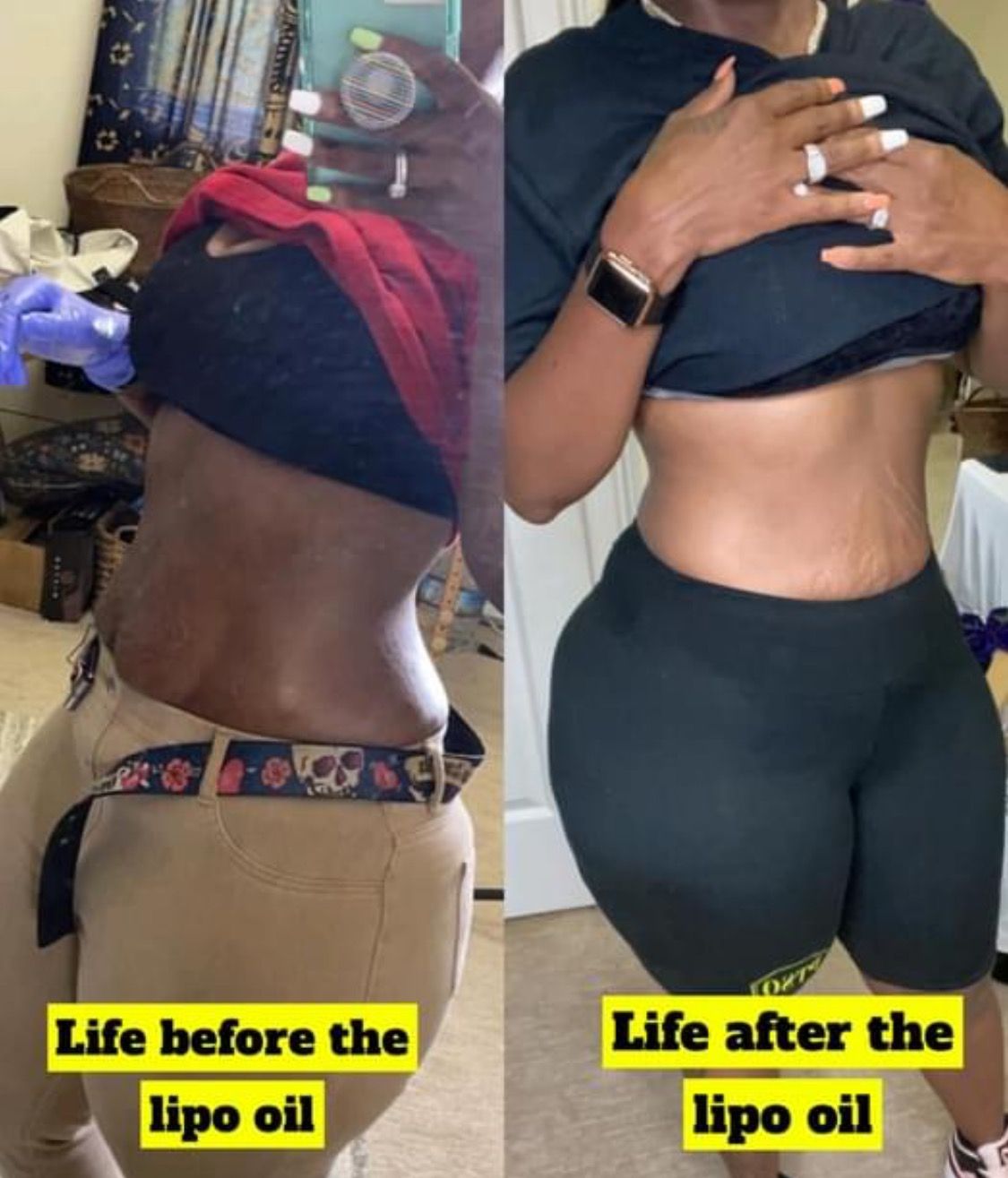 Post-Op & Lymphatic Care