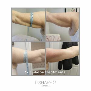 A woman is measuring her arms with a tape measure.