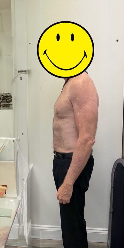 A shirtless man with a smiley face on his head.