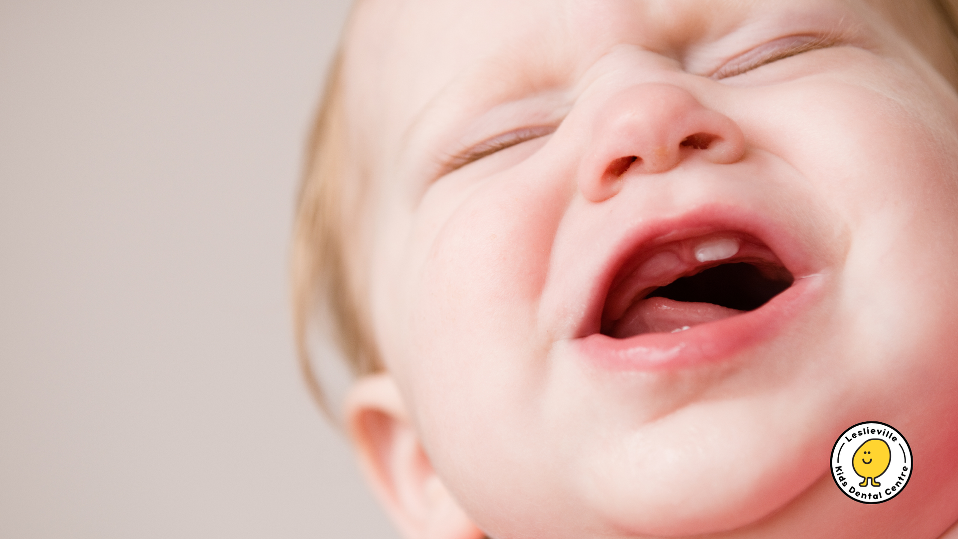 A close up of a baby 's face with its mouth open