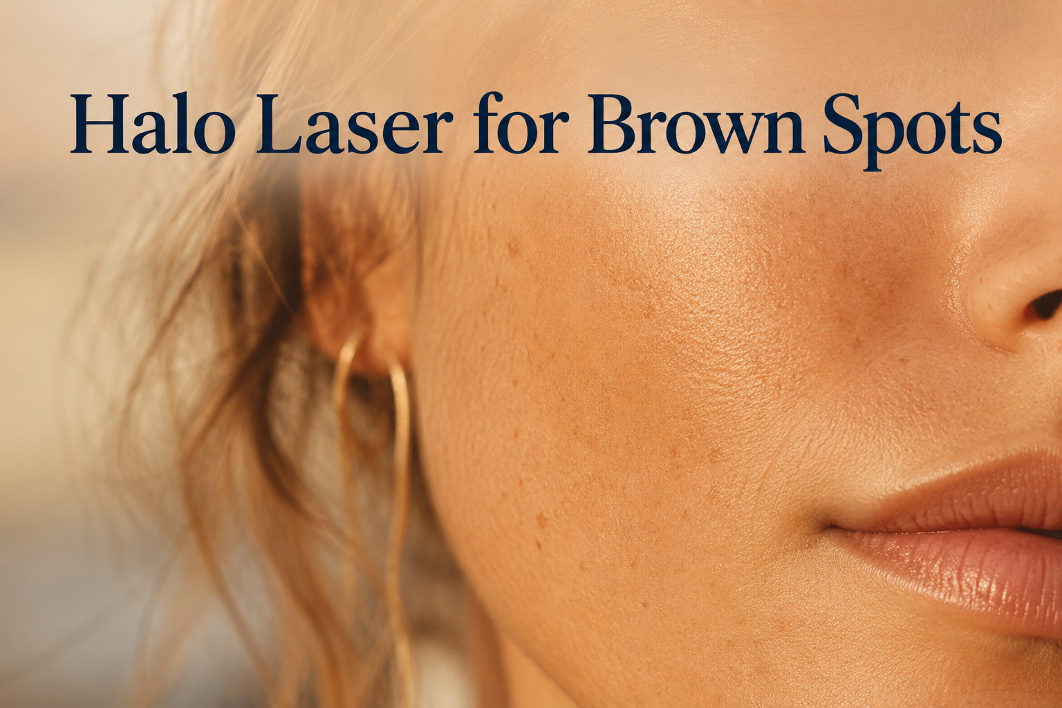 Close-up of sun-exposed cheek skin before Halo Laser brown spot treatment
