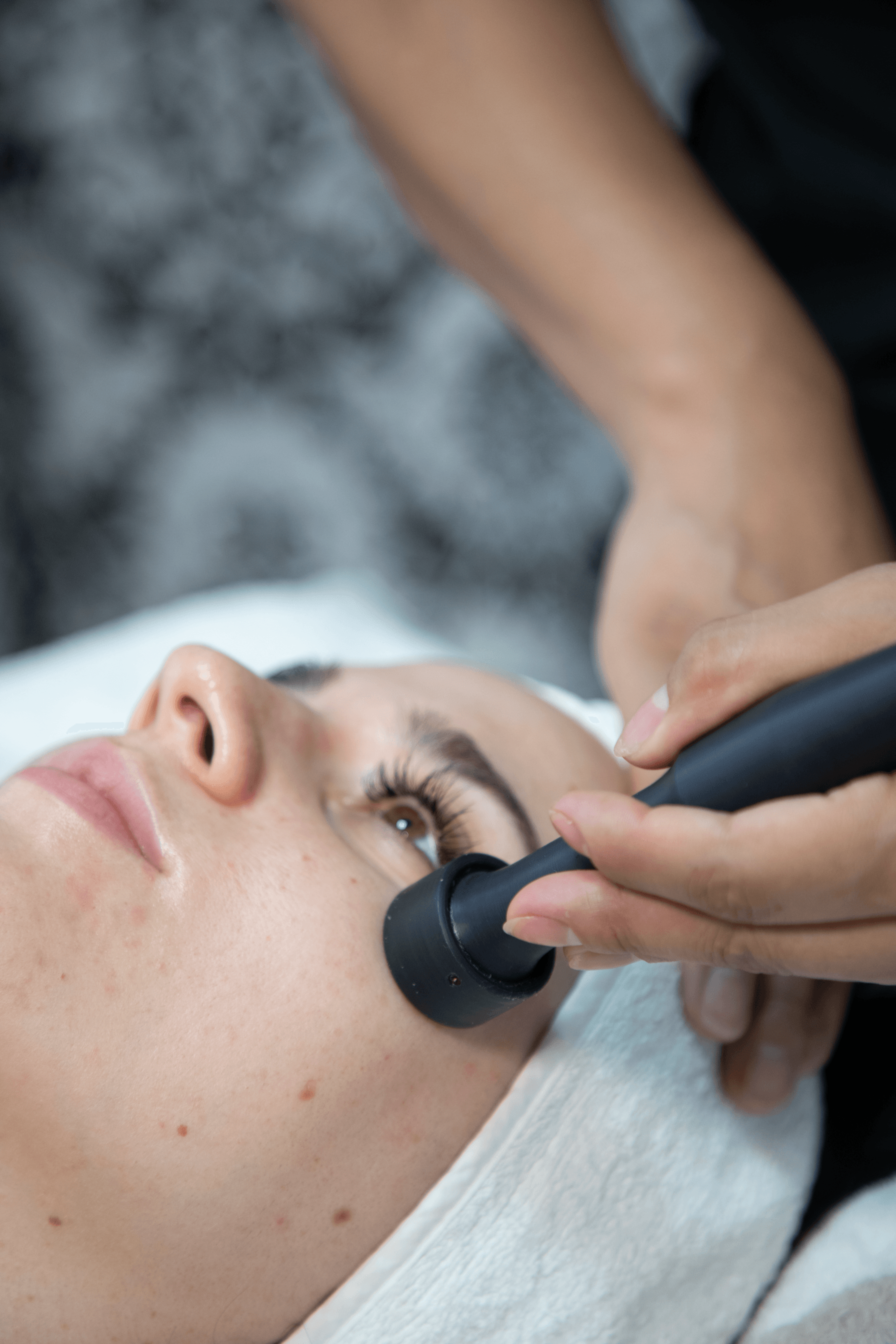 tratamiento de contorno de ojos