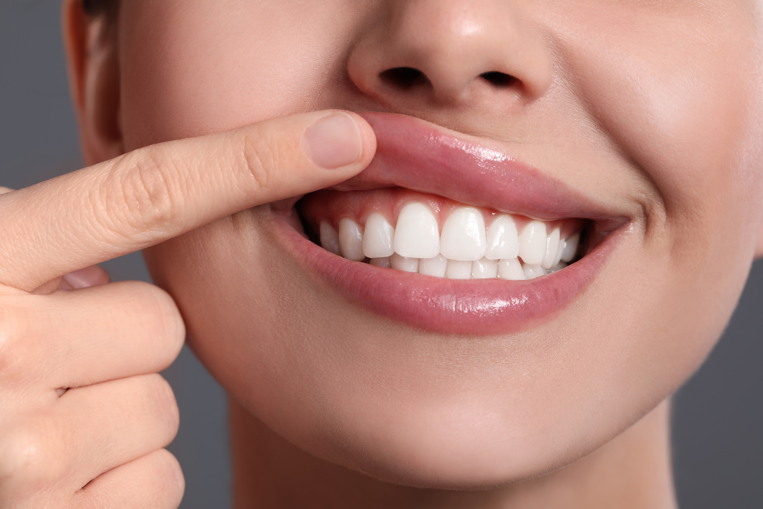 Person smiling while pointing to their white teeth and lips
