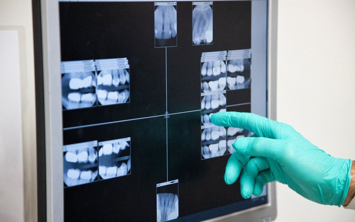 esami diagnostici radiografie