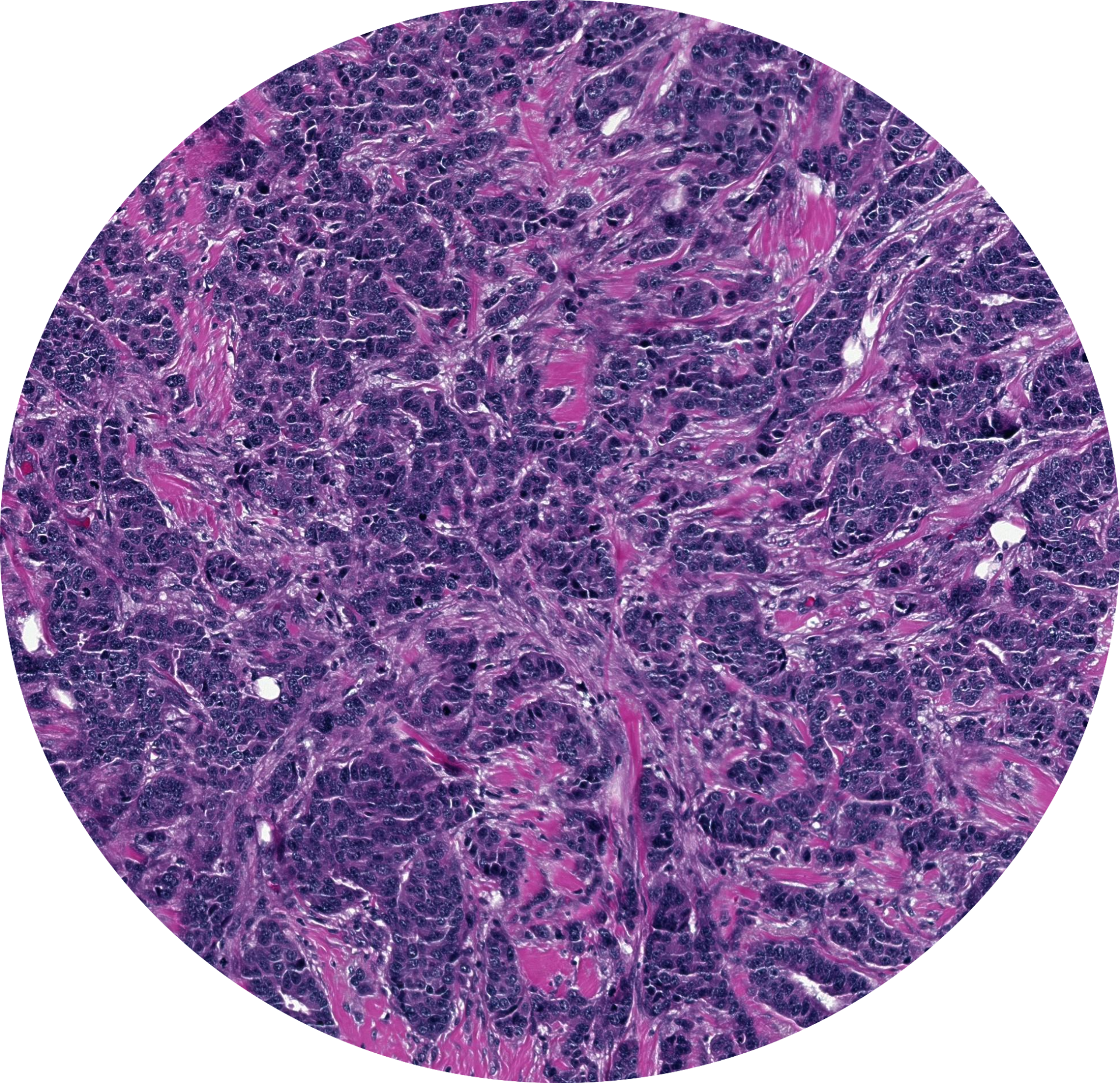 Image of a H&E stained tissue