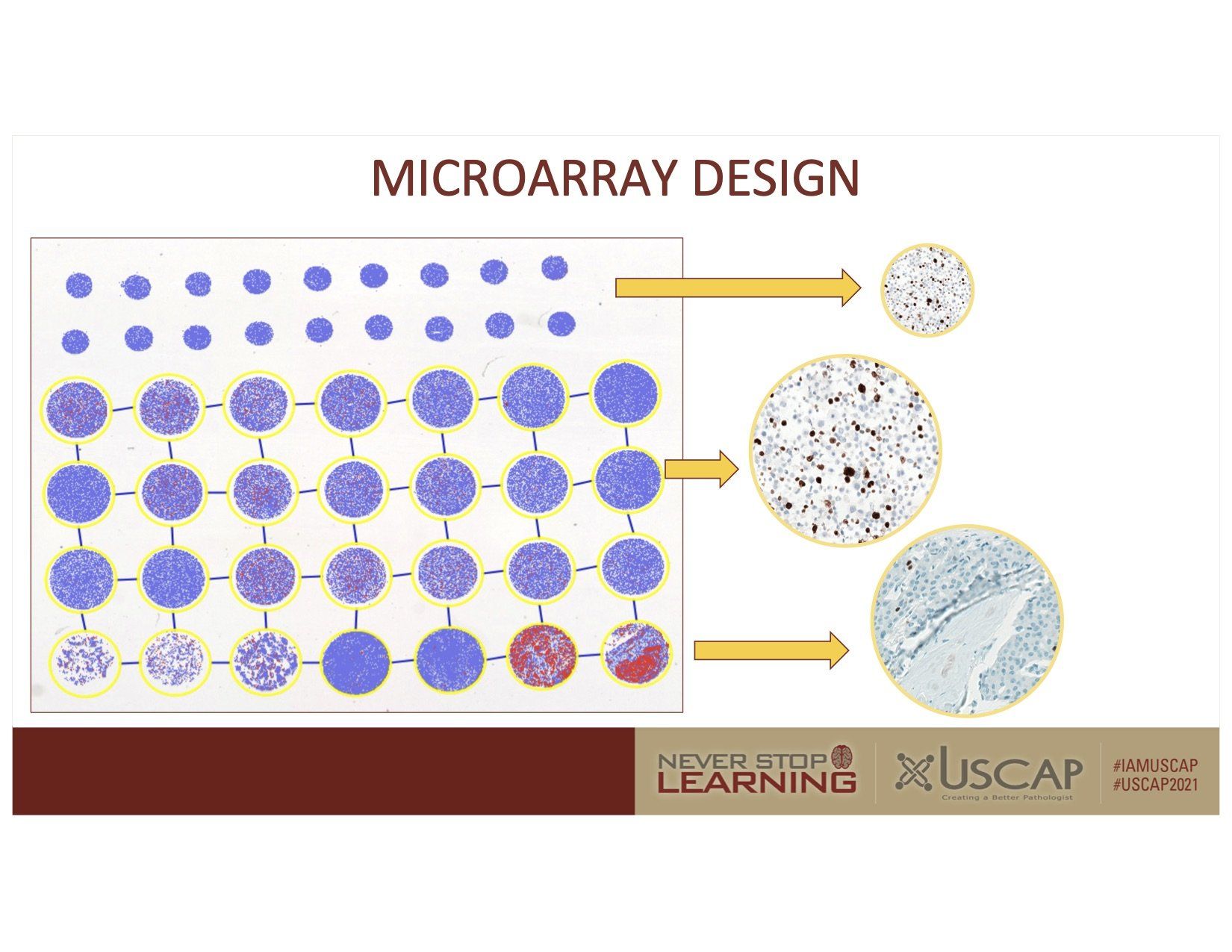 Microarray design diagram with rows of purple spots enlarging into detailed circular samples.
