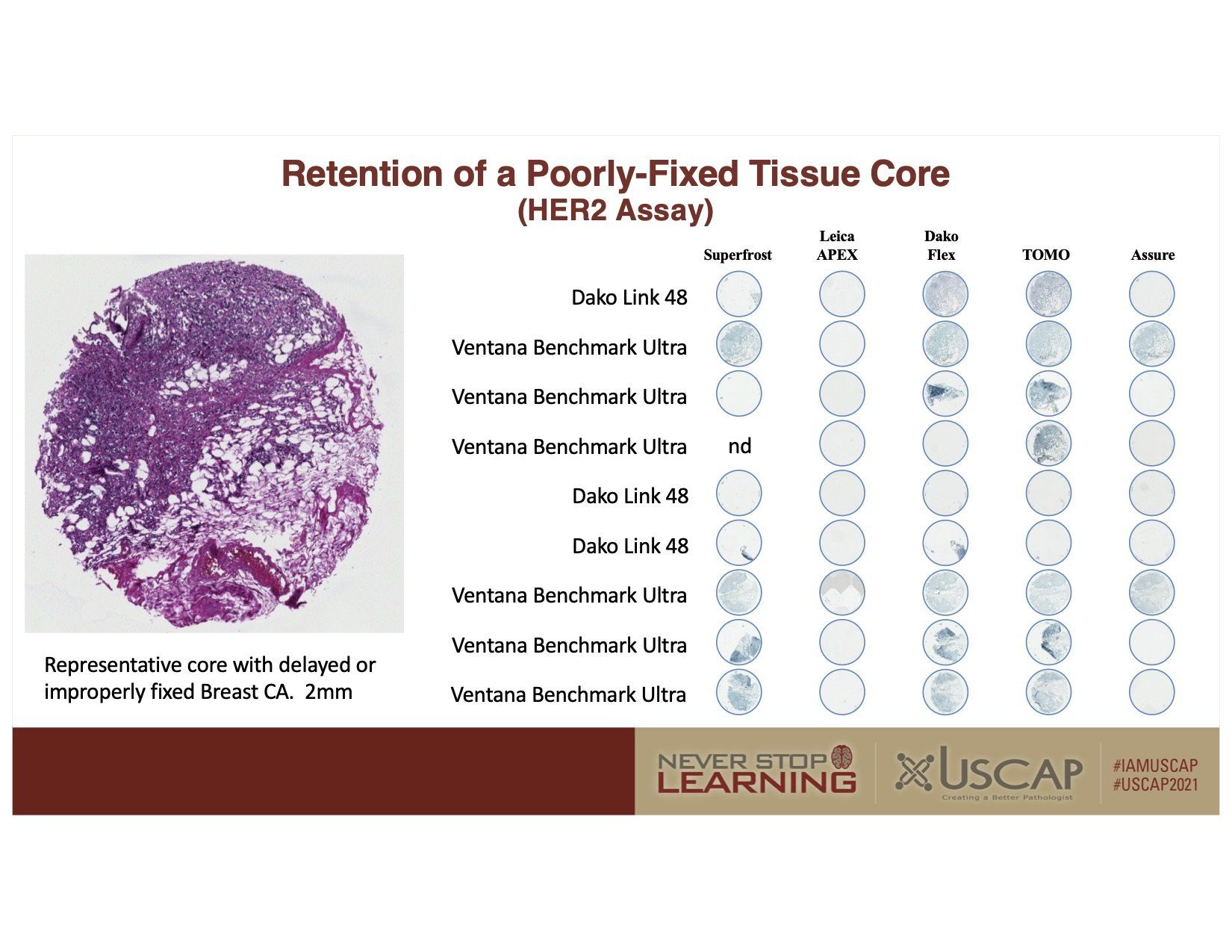 Poster on hEDS assay showing purple tissue core histology and a plate-based staining results chart