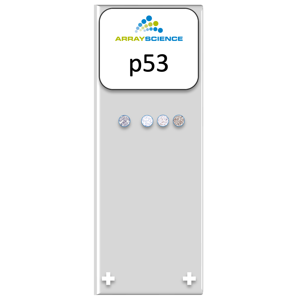 A stylized image of a microscope slide with one tissue core and three cell culture cores representing different p53 expression.