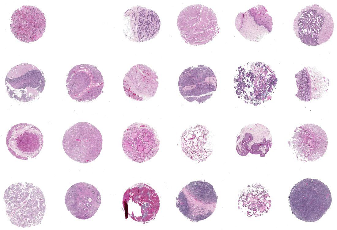 23 tissue cores arranged in a grid on a white background