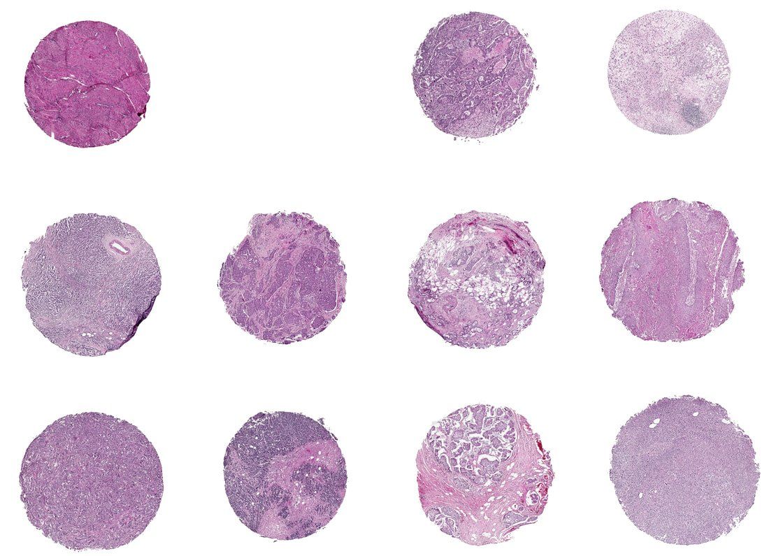 Eleven H&E tissue cores arranged in a 3x4 grid on a white background