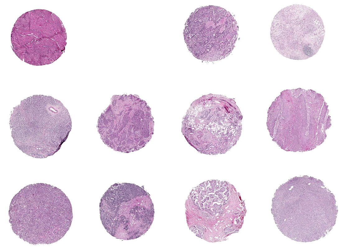 Eleven H&E tissue cores arranged in a 3x4 grid on a white background