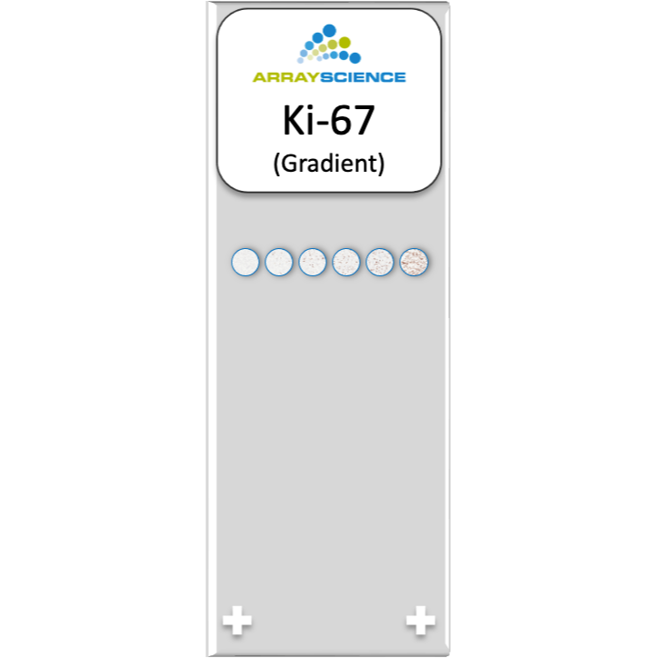 A stylized image of a microscope slides with six cell culture cores expressing different levels of Ki-67 positivity. 