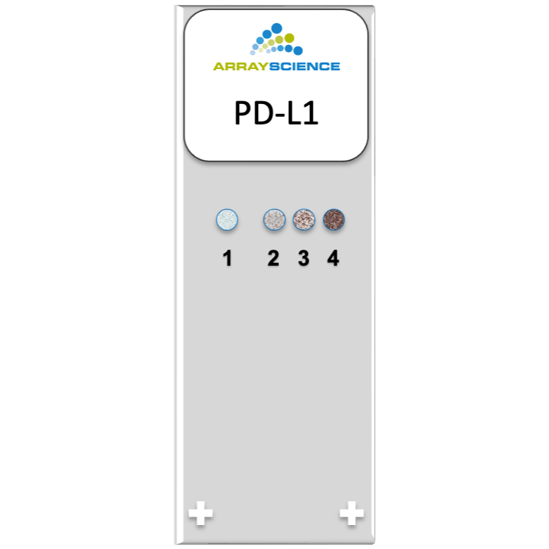 A styled image of a microscope slide with four cell cultures cores expressing different levels of PD-L1. 
