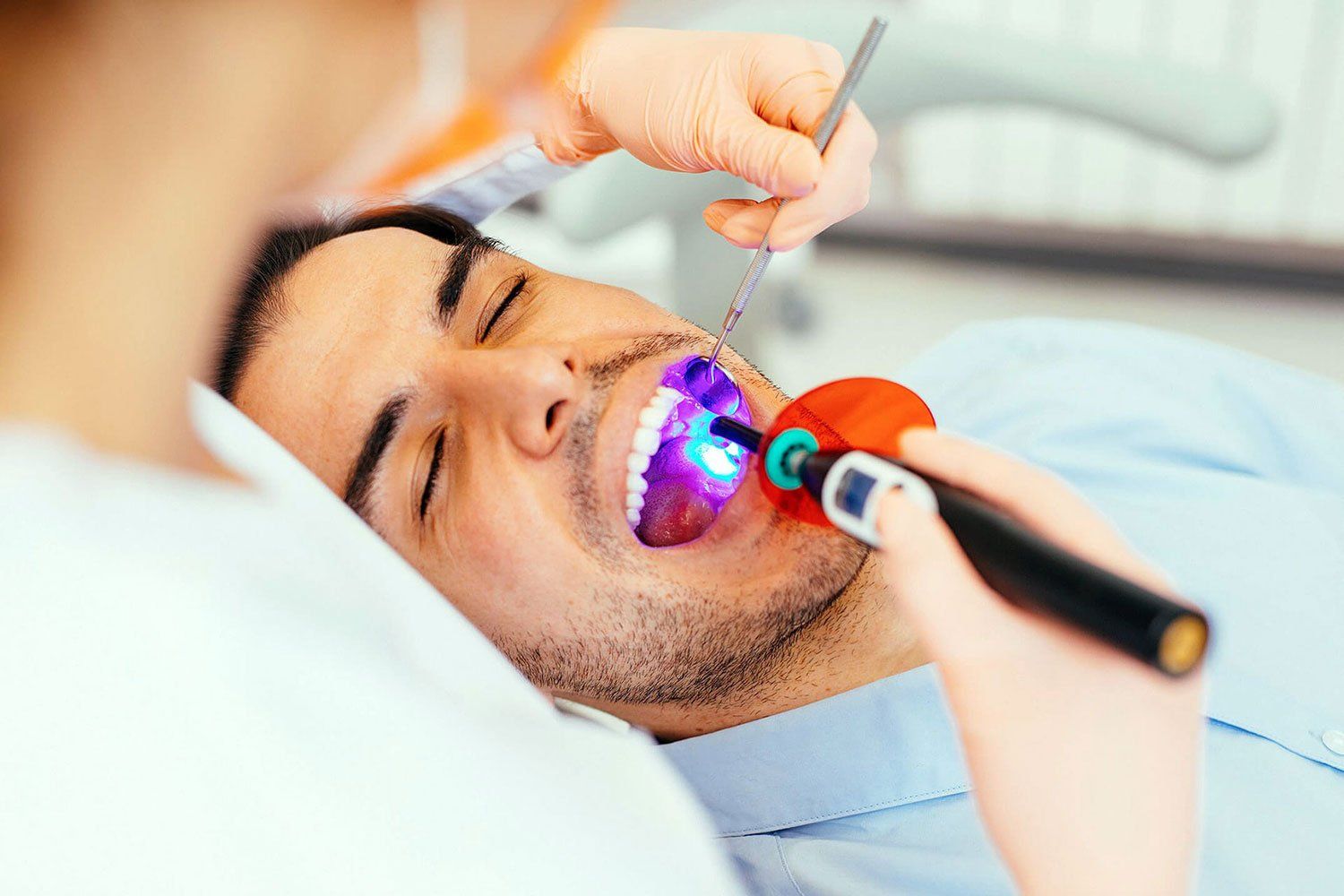 igiene dentale e sbiancamento