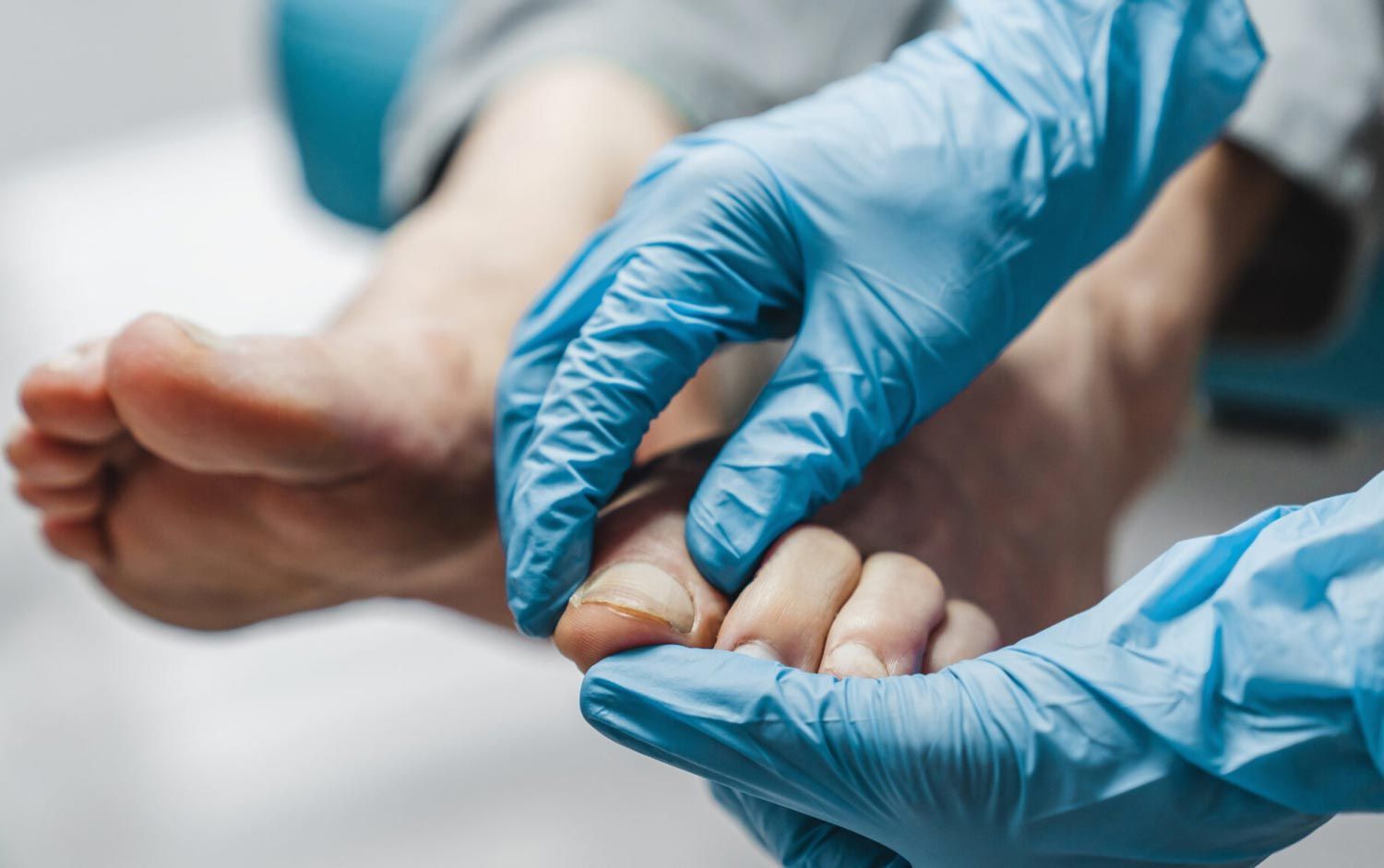 A person wearing blue gloves is examining another person 's foot.