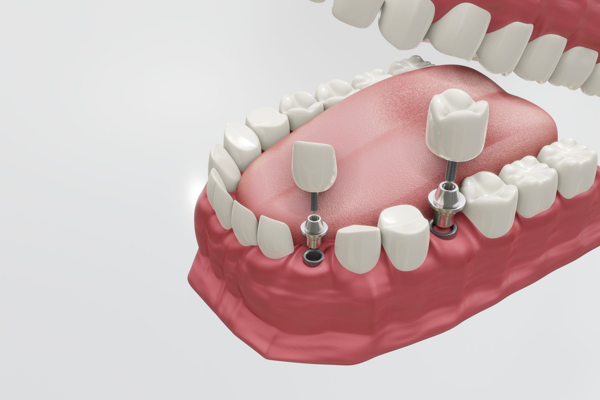 Dentist pointing at teeth on a screen during a consultation in an office.