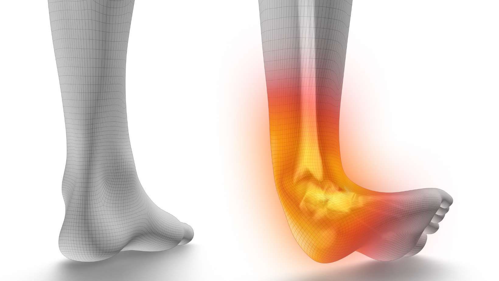 Ankle Surgery