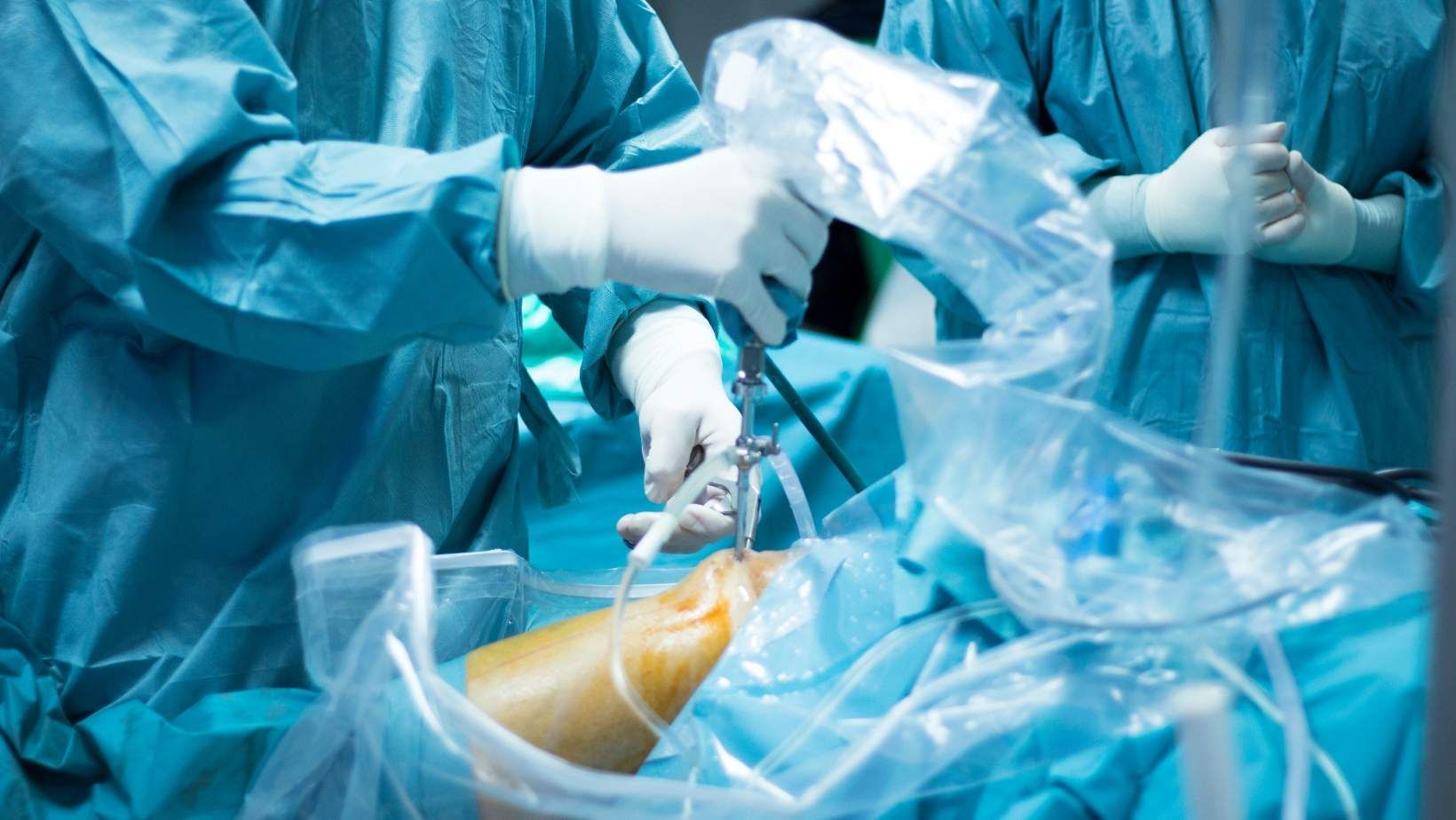 Knee Revision Surgery image
