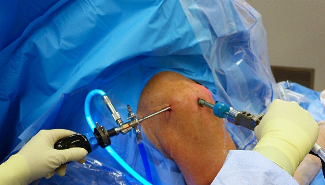 Rotator cuff repair