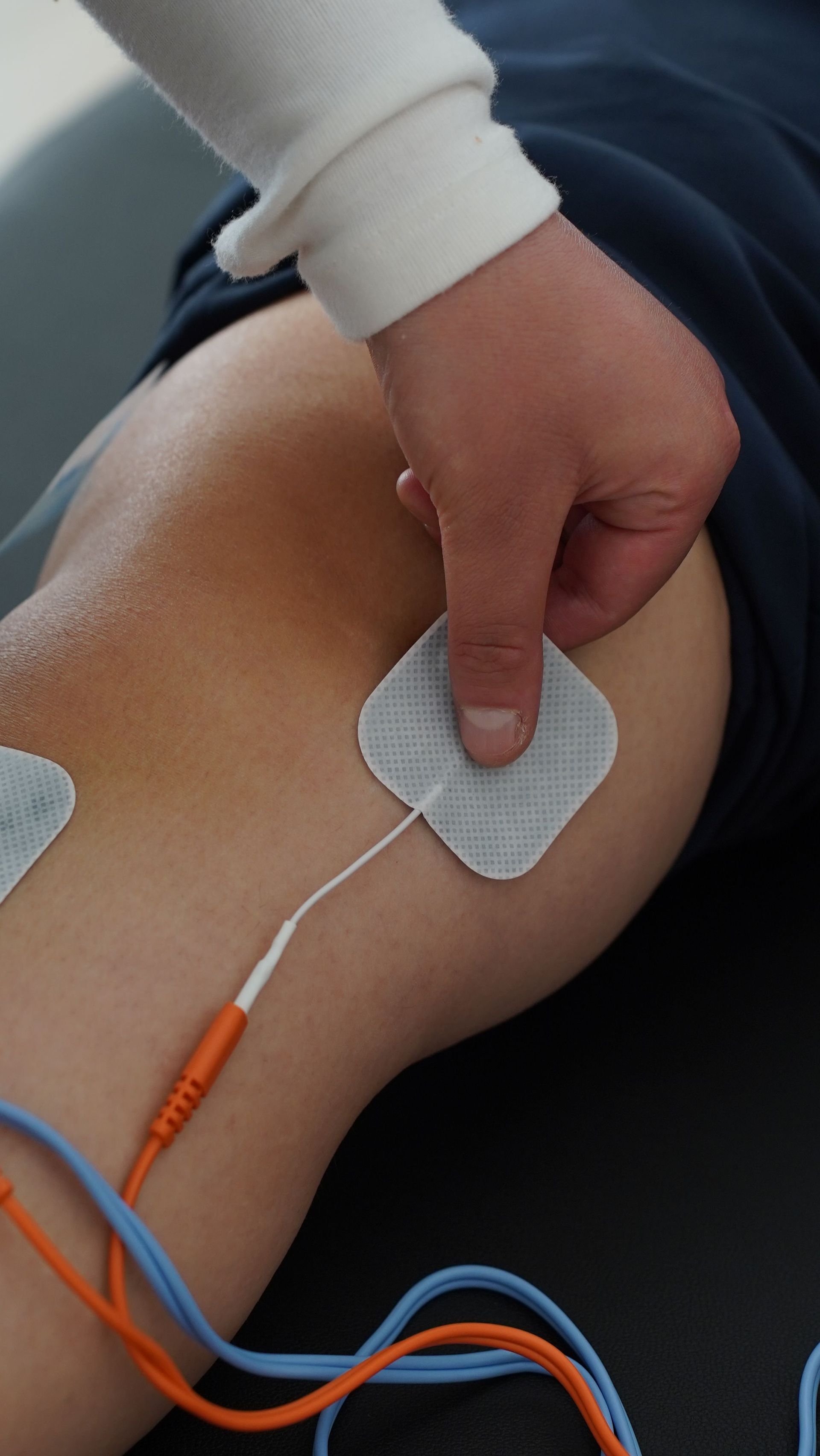 Mano colocando una almohadilla de electrodos en la pierna de un paciente durante la terapia de estimulación eléctrica.