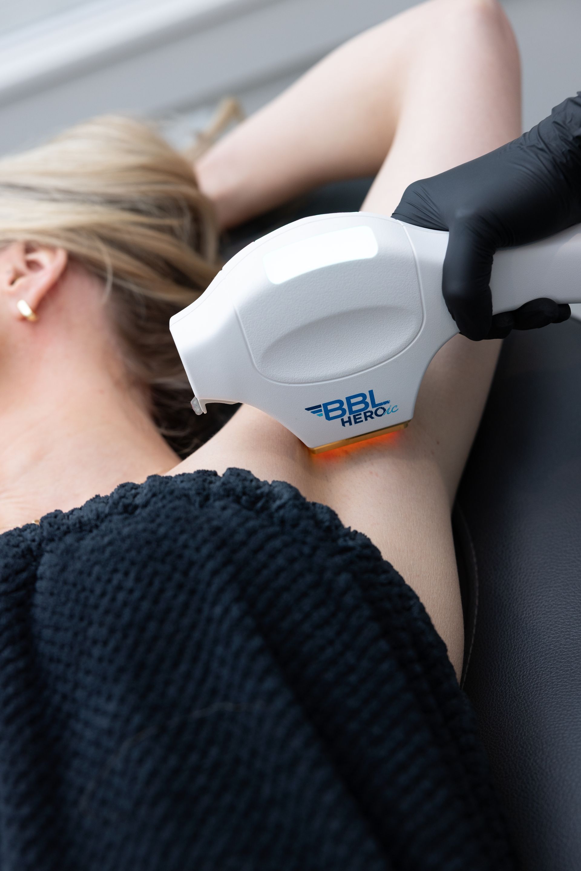 Close-up of laser hair removal on a person’s armpit with a handheld device