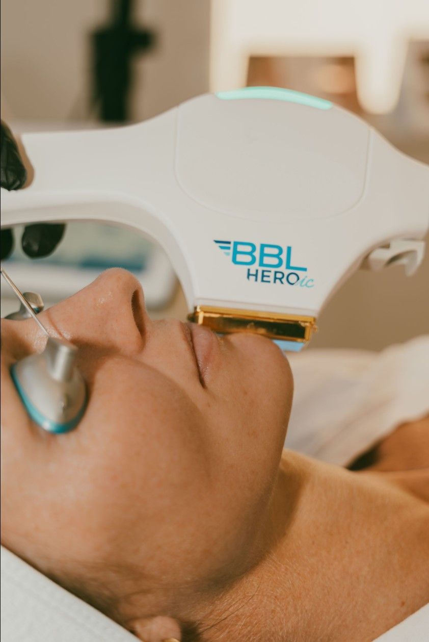 Person receiving a BBL Hero facial treatment with a white handheld device on the cheek