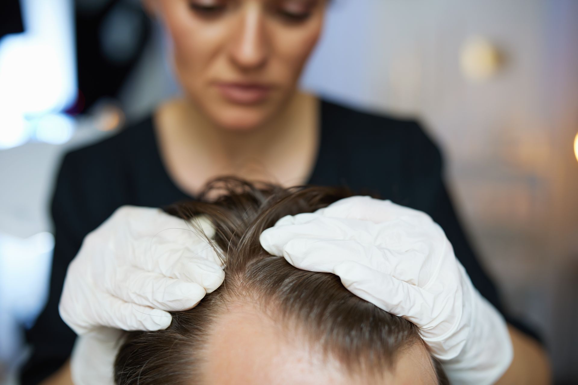 Woman in gloves examining a man's thinning hairline. Close-up, indoors with soft lighting.