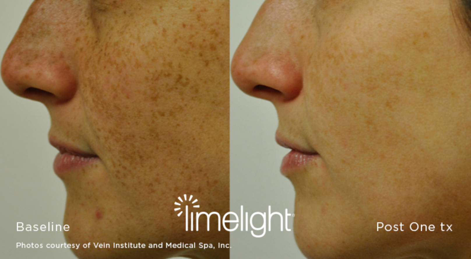before and after skin care management before and after skin care management