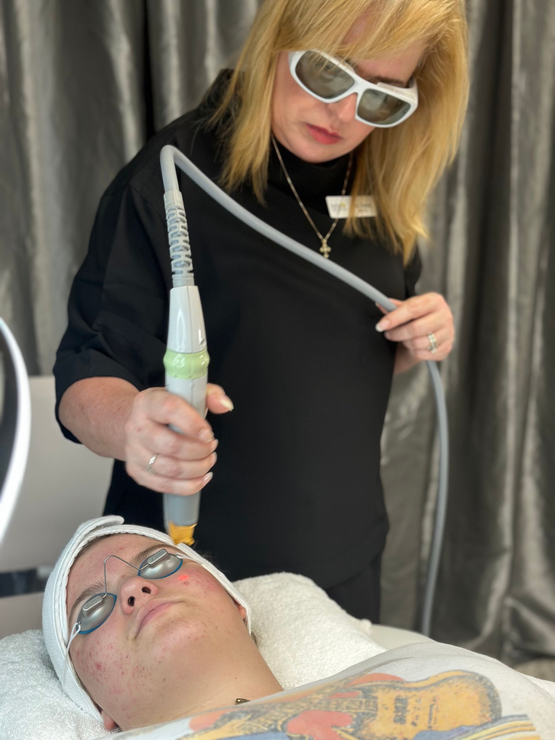 facial laser treatment