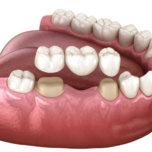 Family Dental and Associates