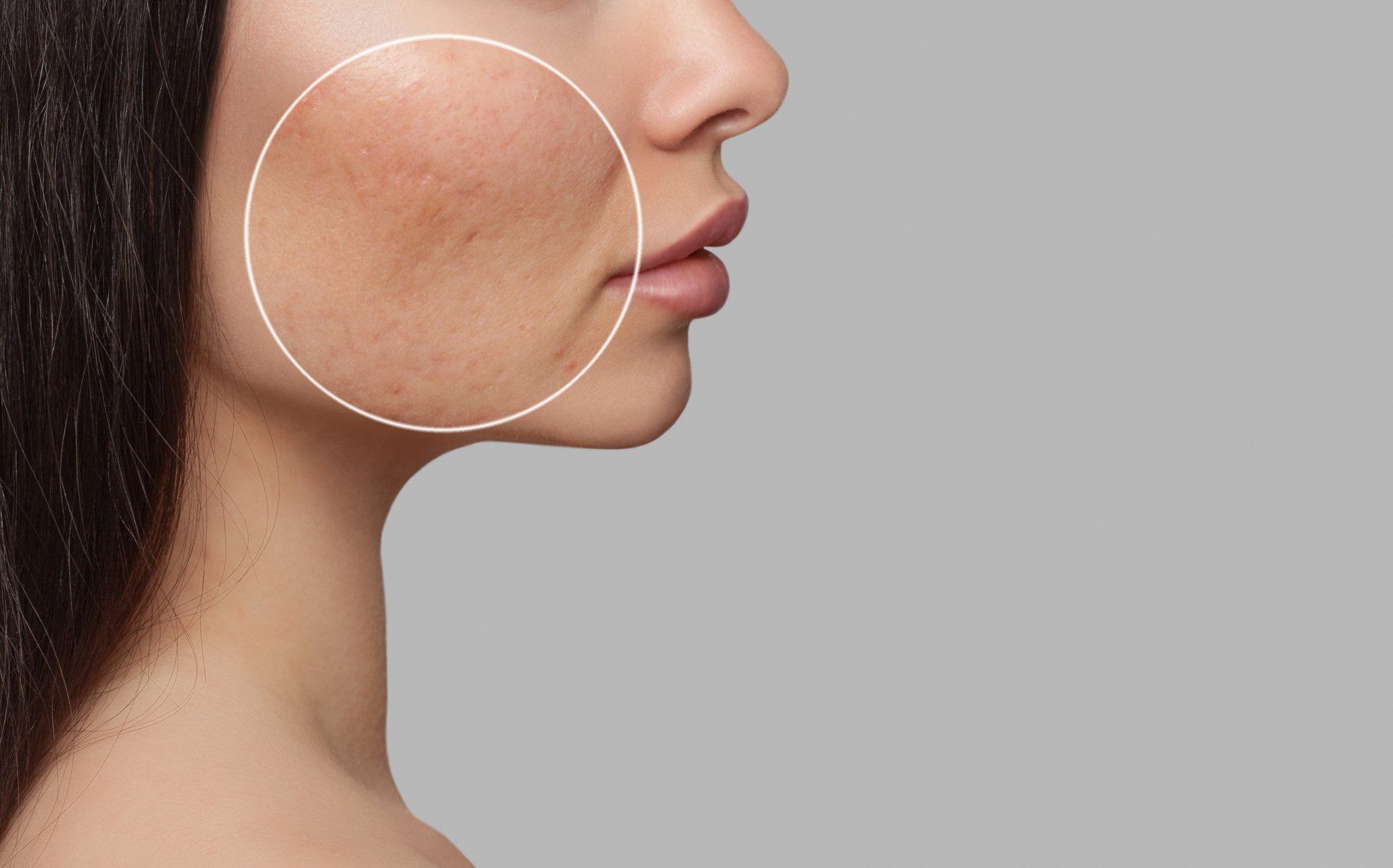 A close up of a woman 's face with a circle around it