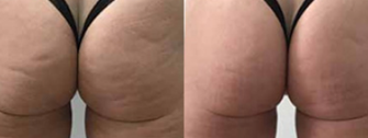 picture of body