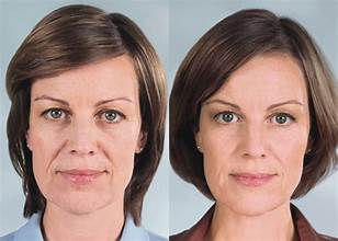 A before and after photo of a woman 's face.
