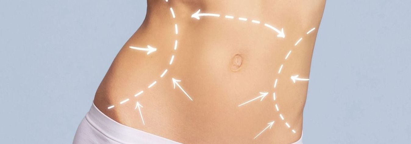 A close up of a woman 's stomach with arrows pointing to it.