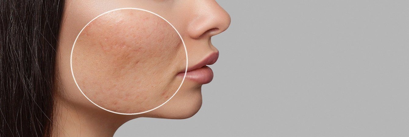 A close up of a woman 's face with a circle around it.