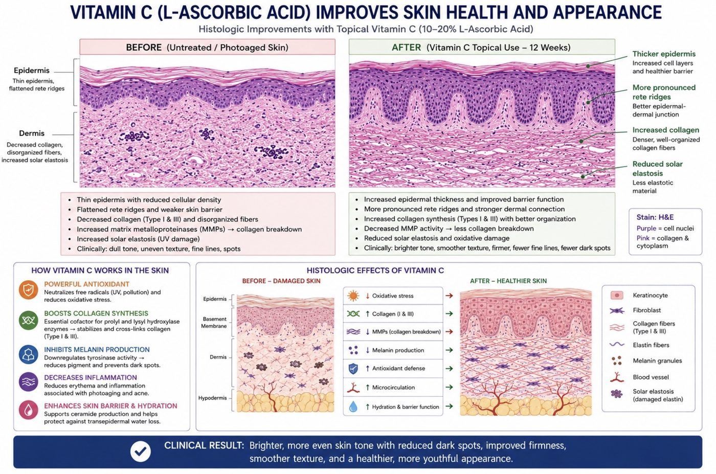 Histology comparison showing thicker epidermis and increased type I and III collagen after 12 weeks of topical vitamin C