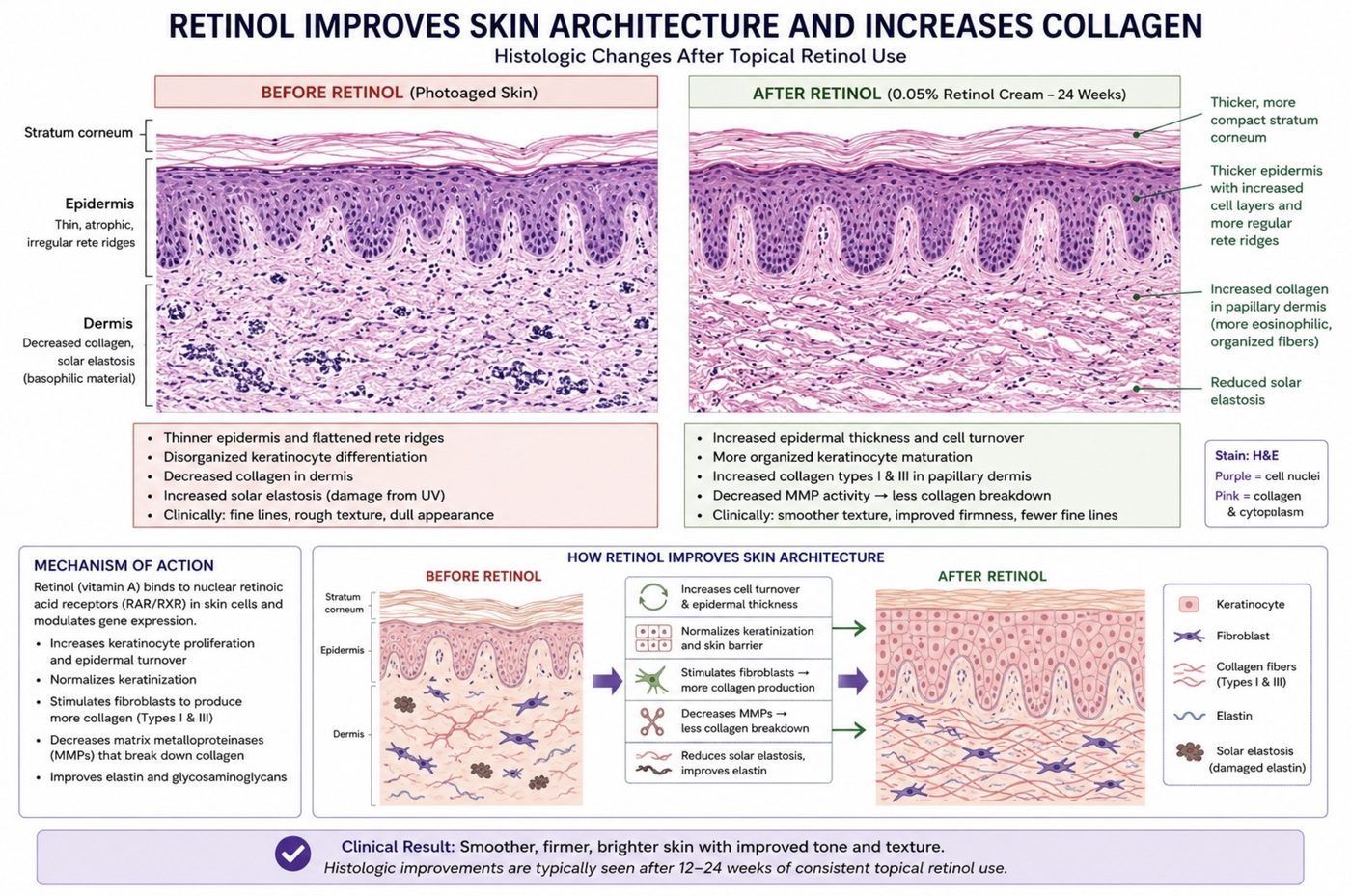 Histology comparison showing thicker epidermis and increased collagen in the dermis after 24 weeks of topical retinol