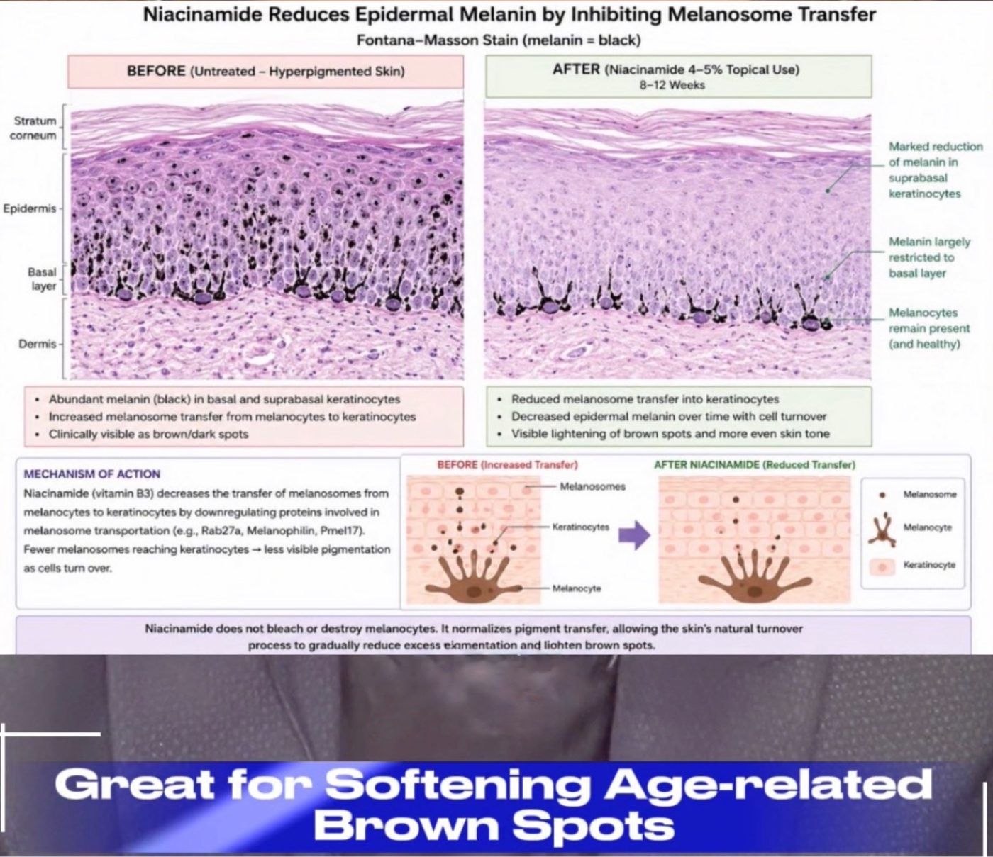 Fontana-Masson stained histology showing reduced epidermal melanin after 8 to 12 weeks of topical niacinamide
