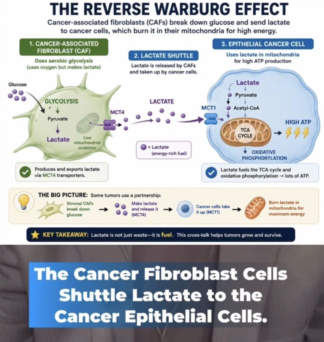 Diagram of the Reverse Warburg Effect: cancer-associated fibroblasts send lactate to epithelial cancer cells, which burn it in their mitochondria for high ATP