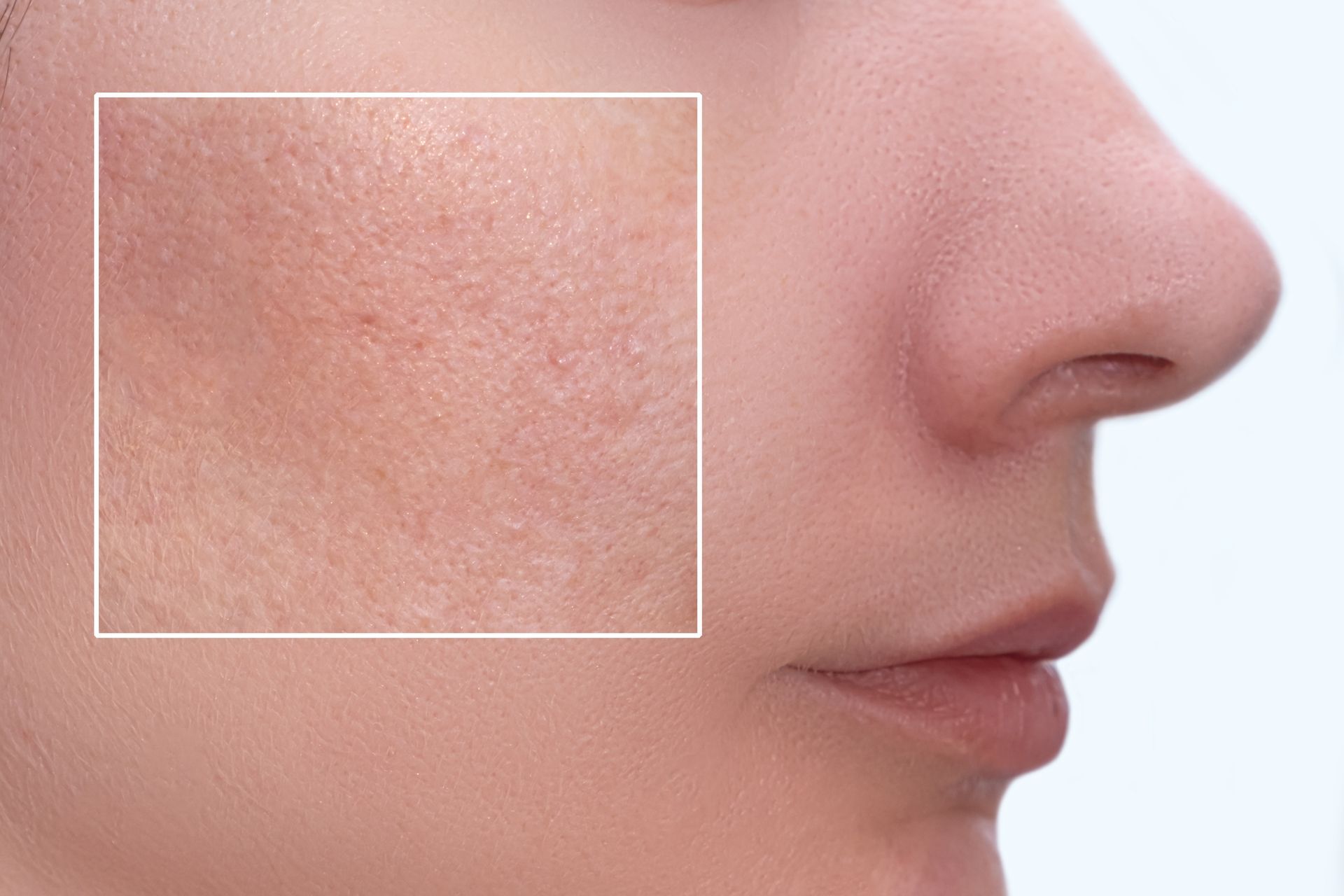 Close-up side profile of a face with a highlighted cheek showing visible skin texture and pores