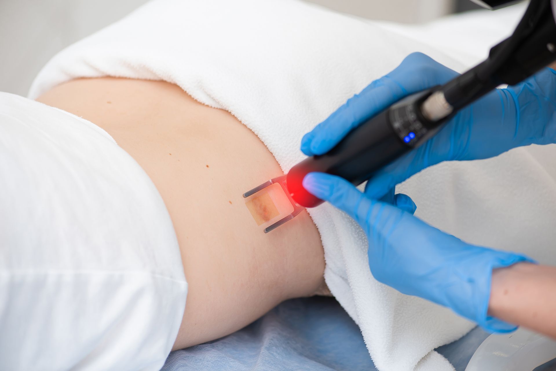 A person is getting a laser treatment on their back.